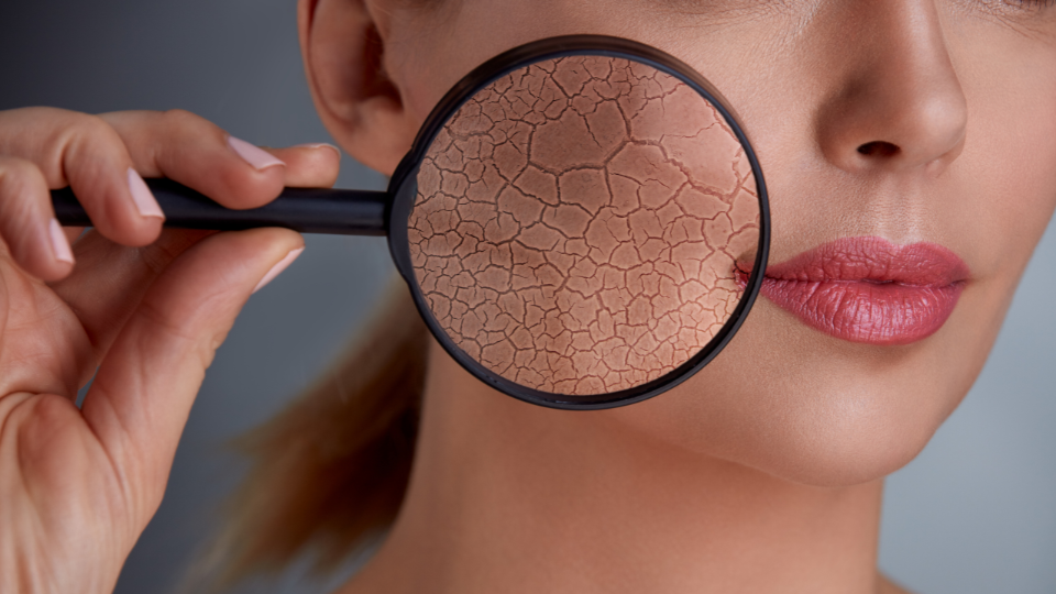 Skin Rejuvenation